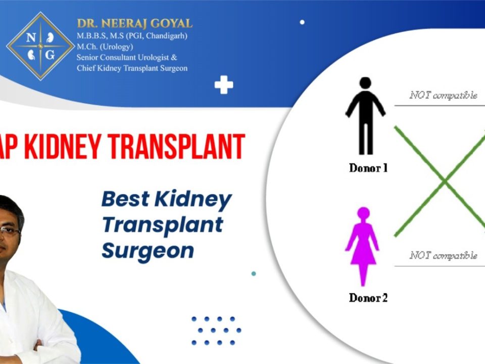 Swap Kidney Transplants